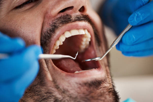 Best Emergency Dental Care for Trauma or Injury in Douglas, MI