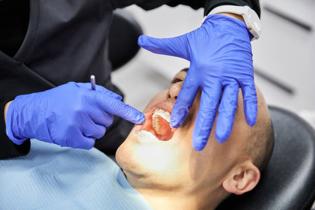 Best Emergency Tooth Extraction in Douglas, MI
