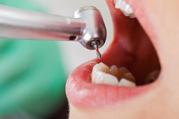 Best Pediatric Emergency Dentist in Douglas, MI